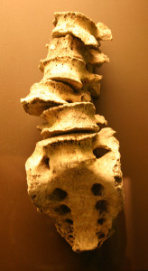 stockvault-spinal-column96479